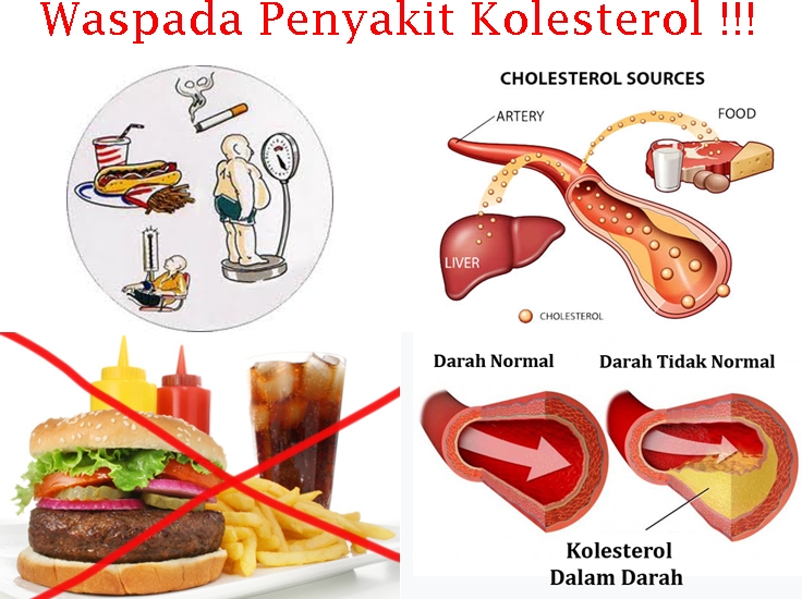 Turunkan Kolesterol Tubuh dengan Minuman dan Makanan Fungsional